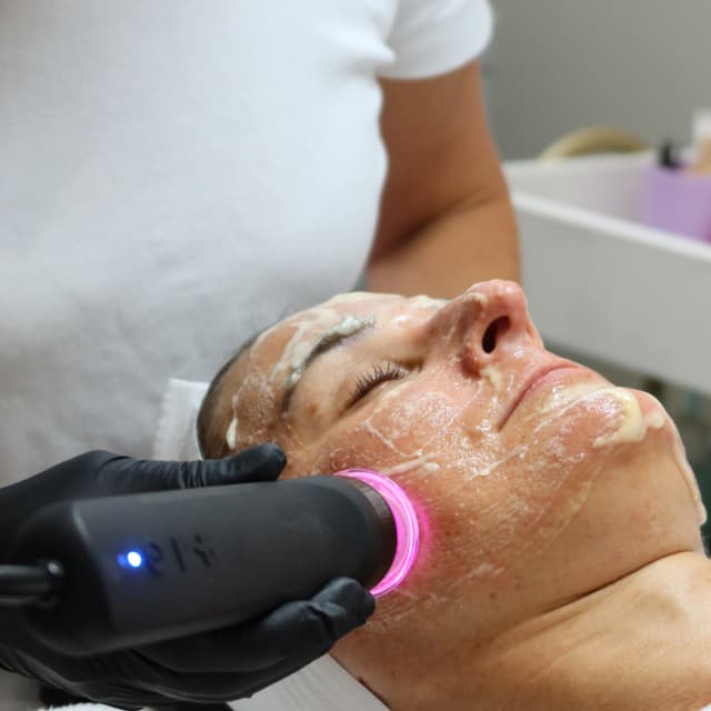 Glo2Facial Essential — 9 Treatments at PolinaSerene in Tenafly, NJ